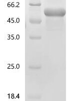 Human Immunoglobulin superfamily containing leucine-rich repeat protein (ISLR) Recombinant Protein - BioCrest Sci
