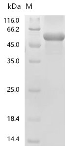 Human Immunoglobulin superfamily containing leucine-rich repeat protein (ISLR) Recombinant Protein, Homo sapiens (Human), E.coli, C-terminal 6xHis-tagged, 50.8 kDa, purity >≥ 85% as determined by SDS-PAGE.