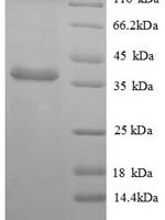 Mouse Apolipoprotein E (Apoe) Recombinant Protein - BioCrest Sci