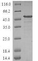 Human Deoxycytidylate deaminase (DCTD) Recombinant Protein - BioCrest Sci