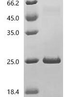 Artemisia vulgaris Art v 2 allergen (art v 2) Recombinant Protein, C-His, aa 24–162, E.coli - BioCrest Sci
