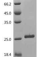 Human Large ribosomal subunit protein eL31 (RPL31) Recombinant Protein - BioCrest Sci