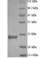 Human Caspase-5 (CASP5), partial Recombinant Protein - BioCrest Sci