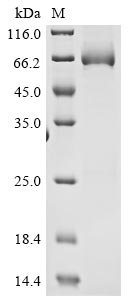 Mouse High affinity cGMP-specific 3,5-cyclic phosphodiesterase 9A (Pde9a) Recombinant Protein, N-His, Mus musculus (Mouse), E.coli, N-terminal 6xHis-tagged, 65.7 kDa, purity >≥ 85% as determined by SDS-PAGE.