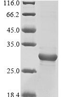 Pan troglodytes Adrenomedullin (ADM) Recombinant Protein - BioCrest Sci