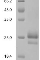 Rat Interferon beta (Ifnb1) Recombinant Protein, N-His - BioCrest Sci