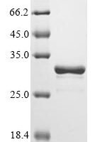 Salmonella typhimurium Beta-lactamase CTX-M-2 (bla) Recombinant Protein - BioCrest Sci
