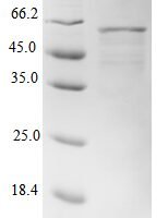 Human DNA dC->dU-editing enzyme APOBEC-3G (APOBEC3G) Recombinant Protein - BioCrest Sci