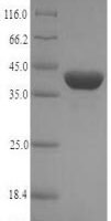 Hepatitis E virus genotype 3 Pro-secreted protein ORF2(ORF2), partial Recombinant Protein, N-His-SUMO - BioCrest Sci