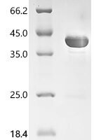 Replication initiation protein (repA), partial Recombinant Protein - BioCrest Sci