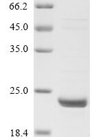 Human Interferon-induced guanylate-binding protein 2 (GBP2), partial Recombinant Protein - BioCrest Sci