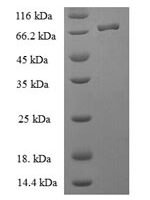 Human BAG family molecular chaperone regulator 5 (BAG5) Recombinant Protein - BioCrest Sci