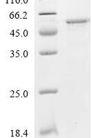 Human E3 SUMO-protein ligase PIAS3 (PIAS3), partial Recombinant Protein - BioCrest Sci