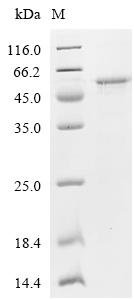 Human E3 SUMO-protein ligase PIAS3 (PIAS3), partial Recombinant Protein, Homo sapiens (Human), E.coli, C-terminal 6xHis-tagged, 46.6 kDa, purity >≥ 85% as determined by SDS-PAGE.