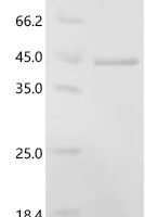 Human P2X purinoceptor 7 (P2RX7), partial Recombinant Protein - BioCrest Sci