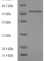 Human Kidney mitochondrial carrier protein 1 (SLC25A30) Recombinant Protein - BioCrest Sci