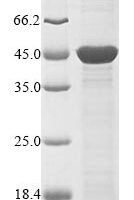 Haemophilus influenzae Outer membrane protein P2 (ompP2) Recombinant Protein - BioCrest Sci