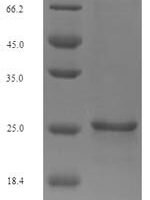 Dendroaspis polylepis polylepis Toxin MIT1 Recombinant Protein - BioCrest Sci