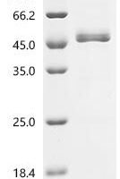 Human S-adenosylmethionine synthase isoform type-2 (MAT2A) Recombinant Protein, N-His, aa 1–395, Yeast - BioCrest Sci