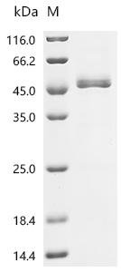 Human S-adenosylmethionine synthase isoform type-2 (MAT2A) Recombinant Protein, N-His, aa 1–395, Yeast, Homo sapiens (Human), Yeast, N-terminal 6xHis-tagged, 45.0 kDa, purity >≥ 90% as determined by SDS-PAGE.
