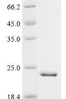 Human Cyclic nucleotide-gated cation channel beta-1 (CNGB1), partial Recombinant Protein - BioCrest Sci
