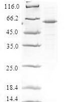 Human Death effector domain-containing protein (DEDD) Recombinant Protein - BioCrest Sci