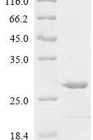 Streptococcus pneumoniae Surface protein pspA (pspA), Partial Recombinant Protein - BioCrest Sci