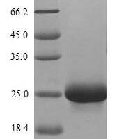 Human ATP-sensitive inward rectifier potassium channel 1 (KCNJ1), partial Recombinant Protein, N-His, aa 178–391, Yeast - BioCrest Sci