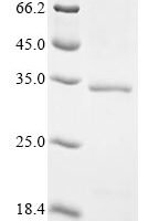 African swine fever virus Uncharacterized protein K145R (Mal-059) Recombinant Protein, N-His-SUMOstar - BioCrest Sci