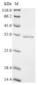 African swine fever virus Uncharacterized protein K145R (Mal-059) Recombinant Protein, N-His-SUMOstar, African swine fever virus (isolate Tick/Malawi/Lil 20-1/1983) (ASFV), Yeast, N-terminal 6xHis-sumostar-tagged, 30.3 kDa, purity >≥ 90% as determined by SDS-PAGE.