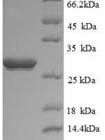 Human Ubiquitin carboxyl-terminal hydrolase isozyme L1 (UCHL1), partial Recombinant Protein - BioCrest Sci