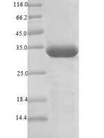 Betula pendula Major pollen allergen Bet v 1-A (BETVIA) Recombinant Protein - BioCrest Sci