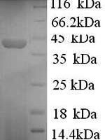 Human Synapsin-1 (SYN1), partial Recombinant Protein, N-His - BioCrest Sci