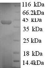 Human Synapsin-1 (SYN1), partial Recombinant Protein, N-His, Homo sapiens (Human), Yeast, N-terminal 6xHis-tagged, 36.6 kDa, purity >≥ 90% as determined by SDS-PAGE.