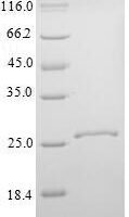 Mouse Kallikrein-14 (Klk14) Recombinant Protein, N-His - BioCrest Sci