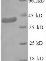 Human Gamma-aminobutyric acid receptor-associated protein (GABARAP), partial Recombinant Protein - BioCrest Sci
