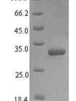 Human Vacuolar protein sorting-associated protein 13A (VPS13A), partial Recombinant Protein - BioCrest Sci