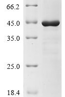 Porphyromonas gingivalis Lys-gingipain (kgp), partial Recombinant Protein, N-10His/C-Myc - BioCrest Sci