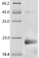 Human Coagulation factor X (F10), partial Recombinant Protein, N-His/C-His - BioCrest Sci
