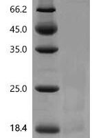 Rat Interferon gamma (Ifng) Recombinant Protein, N-His, aa 23–156, Yeast - BioCrest Sci