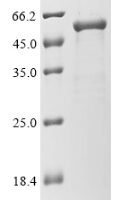 Human Gasdermin-D (GSDMD) Recombinant Protein, N-His - BioCrest Sci