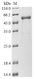 Human Gasdermin-D (GSDMD) Recombinant Protein, N-His, Homo sapiens (Human), E.coli, N-terminal 6xHis-tagged, 56.9 kDa, purity >≥ 85% as determined by SDS-PAGE.