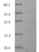 Ceratopteris richardii Cyanovirin-N homolog Recombinant Protein, N-10His - BioCrest Sci