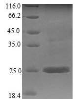 Mouse Stromal cell-derived factor 2 (Sdf2) Recombinant Protein - BioCrest Sci