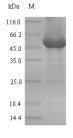 Escherichia coli O6:H1 Exopolyphosphatase (ppx) Recombinant Protein, strain CFT073 / ATCC 700928 / UPEC, Yeast, N-terminal 6xHis-tagged, 60.0 kDa, purity >≥ 90% as determined by SDS-PAGE.