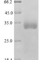 Human Dual specificity mitogen-activated protein kinase kinase 4 (MAP2K4) Recombinant Protein, N-His-GST - BioCrest Sci