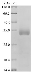 Human Dual specificity mitogen-activated protein kinase kinase 4 (MAP2K4) Recombinant Protein, N-His-GST, Homo sapiens (Human), Yeast, N-terminal 6xHis-GST-tagged, 71.5 kDa, purity >≥ 90% as determined by SDS-PAGE.