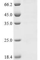 Human Methyltransferase-like protein 25 (METTL25), Biotinylated Recombinant Protein - BioCrest Sci