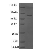 Human Glucosidase 2 subunit beta (PRKCSH), partial Recombinant Protein - BioCrest Sci