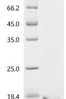 Mouse Tumor necrosis factor receptor superfamily member 16 (Ngfr), partial Recombinant Protein, C-His - BioCrest Sci